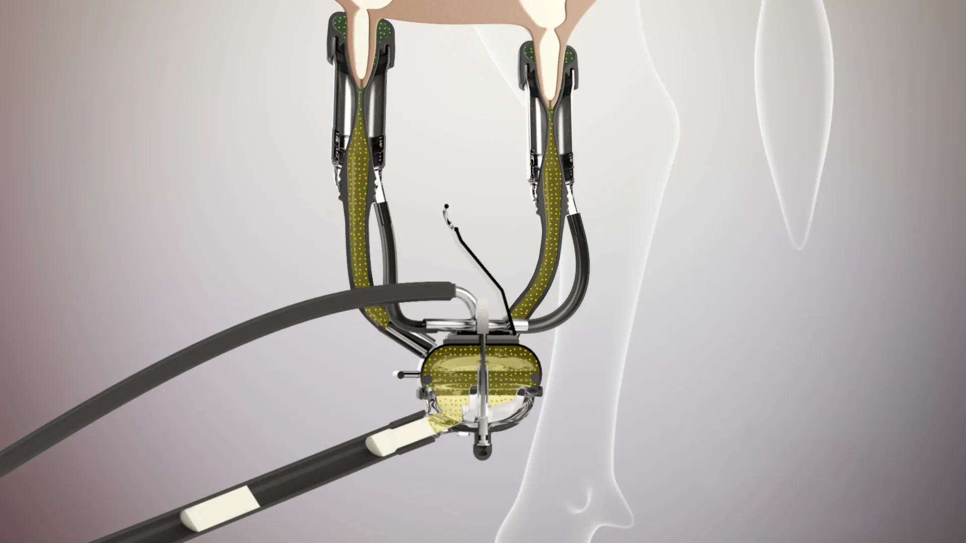 Technische visualisatie van een kabel- en bevestigingssysteem